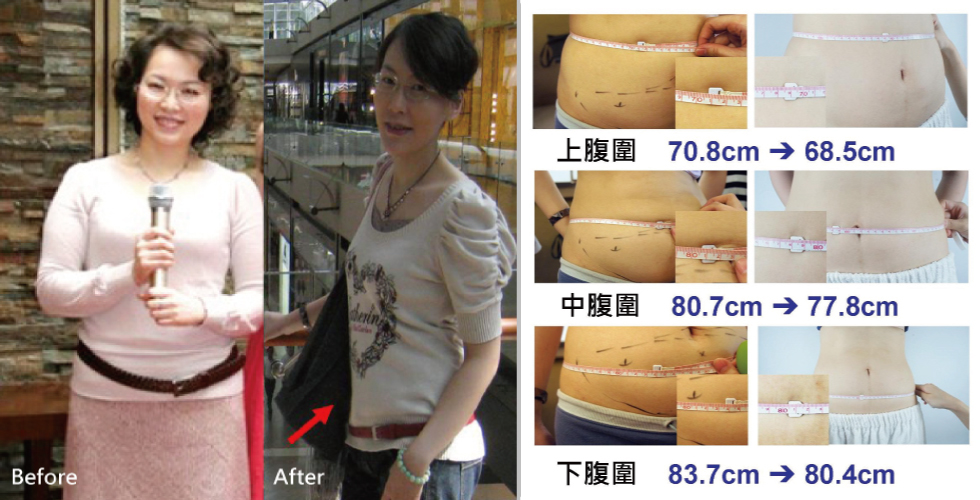 在2010年至2016年的盧醫師真的有很大的改變,有沒有感覺盧醫師越來越年輕了,在他的臉上找不到歲月的痕跡,在身體也是哦~女人,要活的越來越年輕真的不是夢哦~只要和iskin一起選對屬於自己適合的療程。