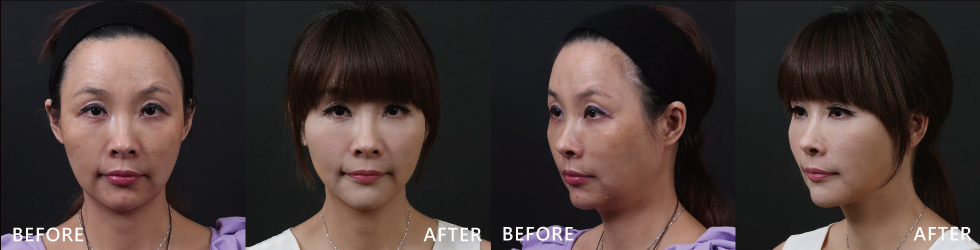 兩百分女人……我,輕鬆蛻變!
