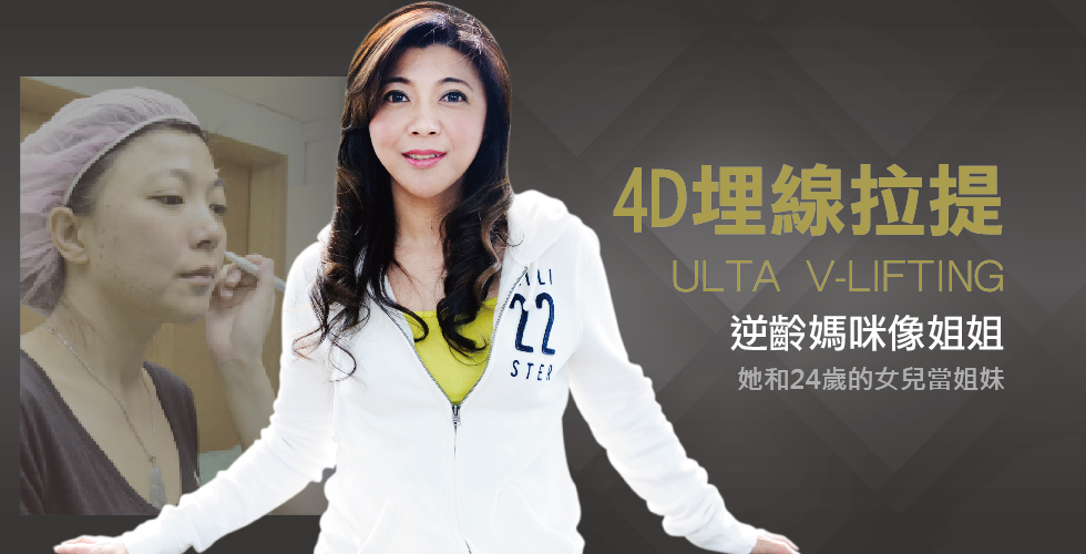 【4D埋線拉皮】逆齡拉提 重現美麗