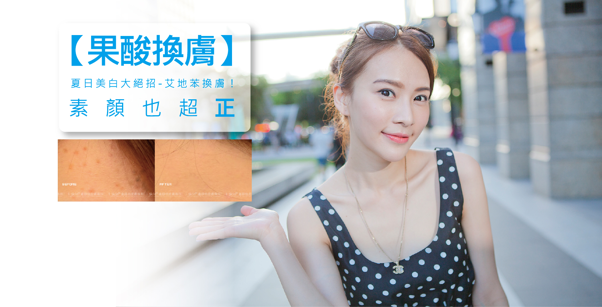 盧靜怡院長受訪GTV《健康NO.1》談指甲健康