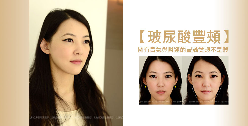 【玻尿酸】擁有貴氣與財運的豐滿雙頰不是夢