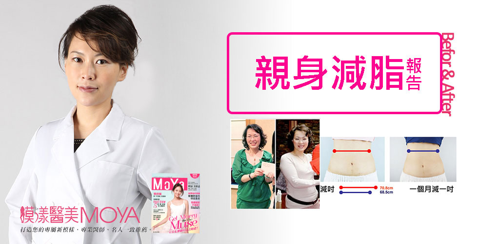 盧靜怡院長受訪《MoYa夏季號》談冷凍減脂-美麗，一絲不苟！