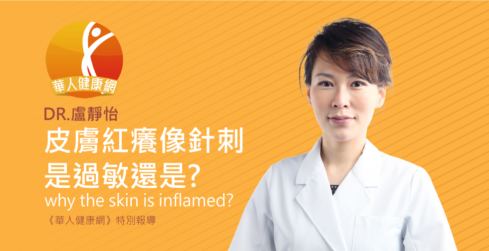 盧靜怡院長受邀《華人健康網》評價胸口發熱、皮膚紅癢像針刺?搞懂是熱過敏，還是慢性蕁麻疹？
