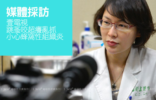 盧靜怡院長受訪《壹電視》談跳蚤咬超癢亂抓
