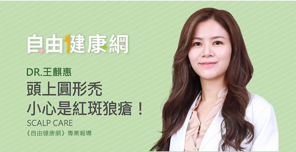 王麒惠醫師受邀《自由健康網》頭上圓形禿小心是紅斑狼瘡！醫：適當治療可改善