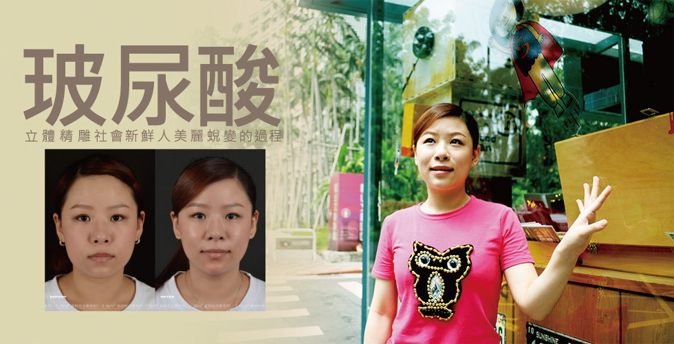 【玻尿酸】 立體精雕 社會新鮮人，美麗蛻變的過程。