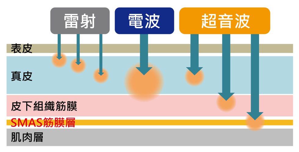 雷射光電療程，別執著「單價」「條數」「發數」﹗安全＋有效，才是IN道理！