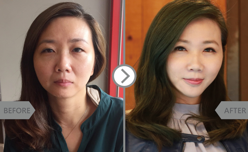原本自己以為只需改善淚溝及法令紋,但醫師卻用玻尿酸,除了改善原本我在意地的部位,還雕塑唇形與下巴讓整體臉型比例更好了!