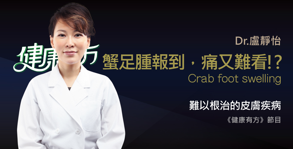 盧靜怡醫師受邀《健康有方》蟹足腫