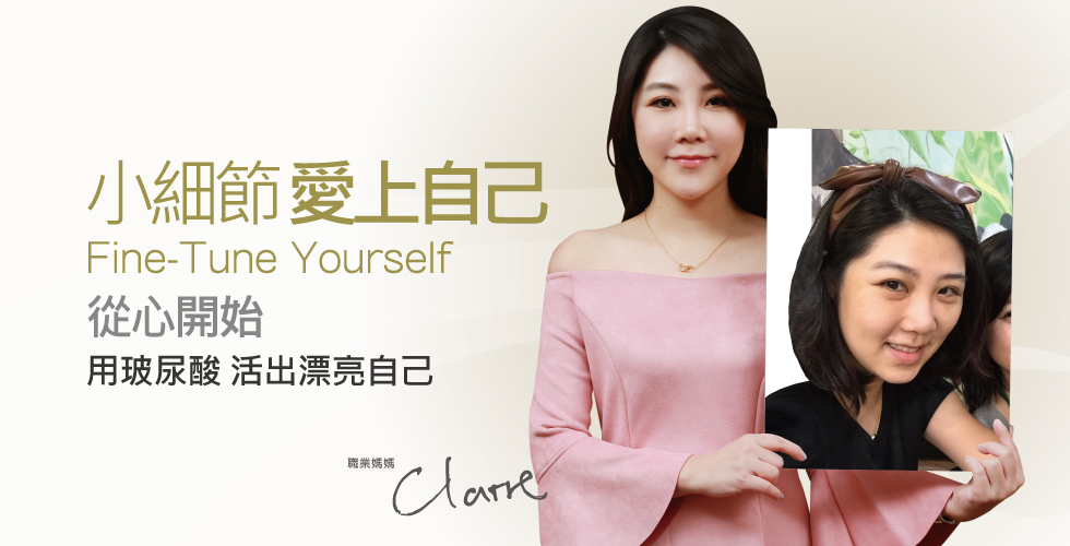 【玻尿酸】熱愛生活 細微變化從心愛上自己─職業媽媽Claire之心得