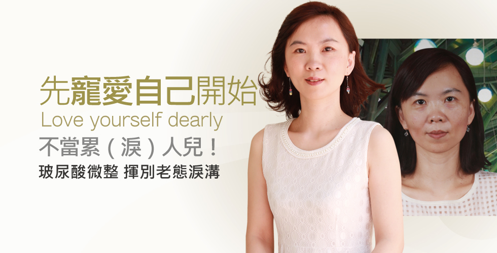 【玻尿酸】先從寵愛自己開始