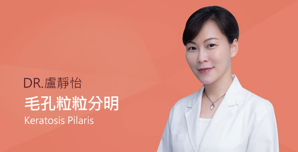 【盧靜怡醫師】談毛孔角化症是什麼？