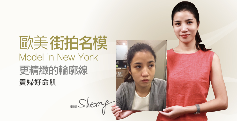【玻尿酸】歐美街拍名模範兒護理師_ Sherry之評價心得