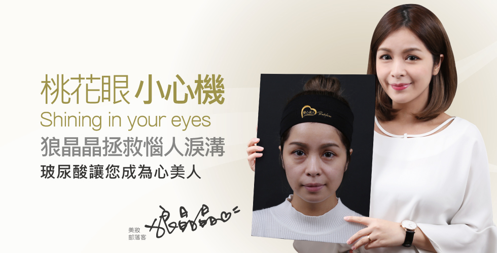 【玻尿酸】桃花眼的小心機，狼晶晶拯救惱人淚溝