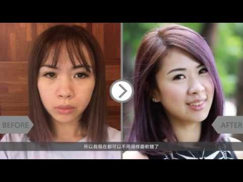 iSkin 盧靜怡皮膚專科診所【玻尿酸】修圖軟體再見了_髮型師Blue