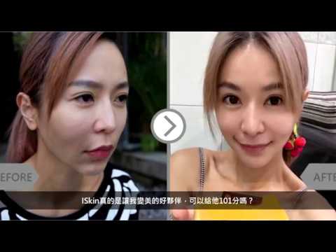 iSkin 盧靜怡皮膚專科診所【玻尿酸】女神肌密揭露 性感女神Via