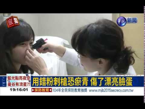 iskin盧靜怡院長受邀《華視新聞》粉刺槍吸粉刺，小心吸出大瘀青