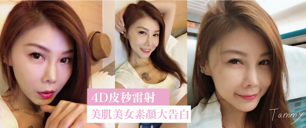 【4D皮秒雷射見證與評價】美肌姐姐Tammy的告白