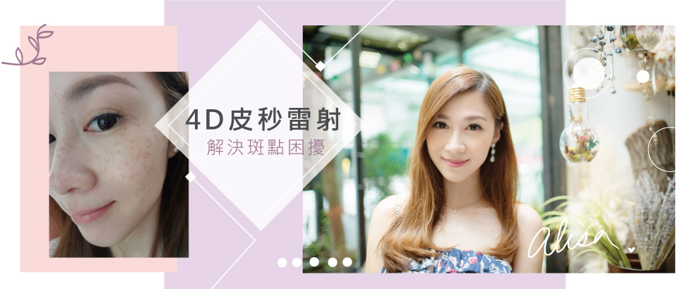 【4D皮秒雷射見證與評價】打理家務不大意，美麗再忙不隨意-Alisa