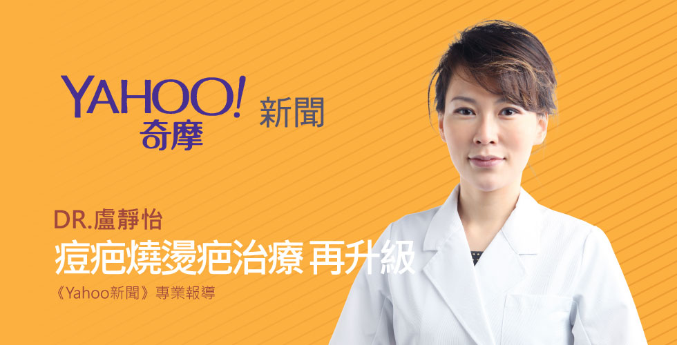 靜怡院長受邀《Yahoo新聞》痘疤燒燙疤有救 醫學雷射UP再升級