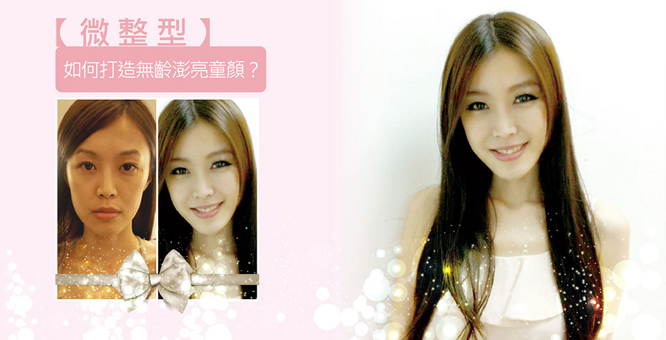 【微整型】如何打造無齡澎亮童顏？