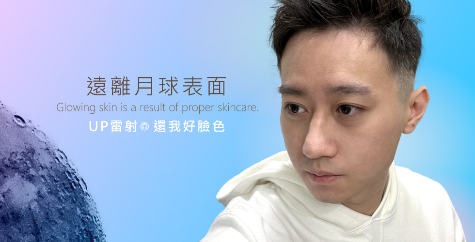 【雷射光療】遠離月球表面 UP雷射還我好臉色 –Alex