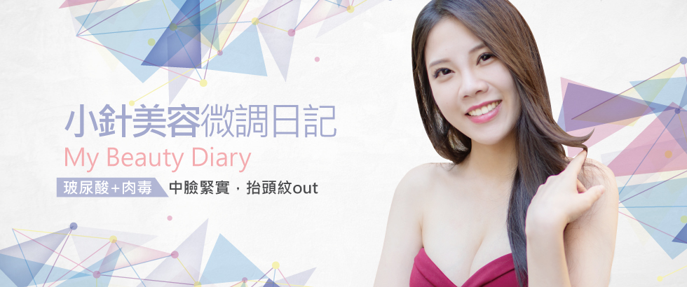 【玻尿酸+除皺瘦臉針注射見證與評價】找回美麗自信- BABY
