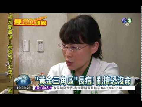 iskin盧靜怡院長受訪《華視新聞》痘痘別亂擠！細菌感染恐沒命