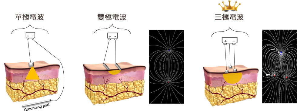 GeneoX 是什麼？