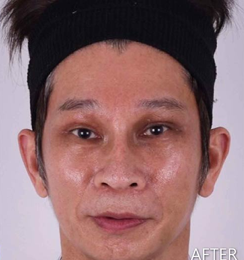 張先生