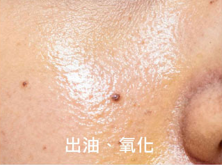 出油、氧化