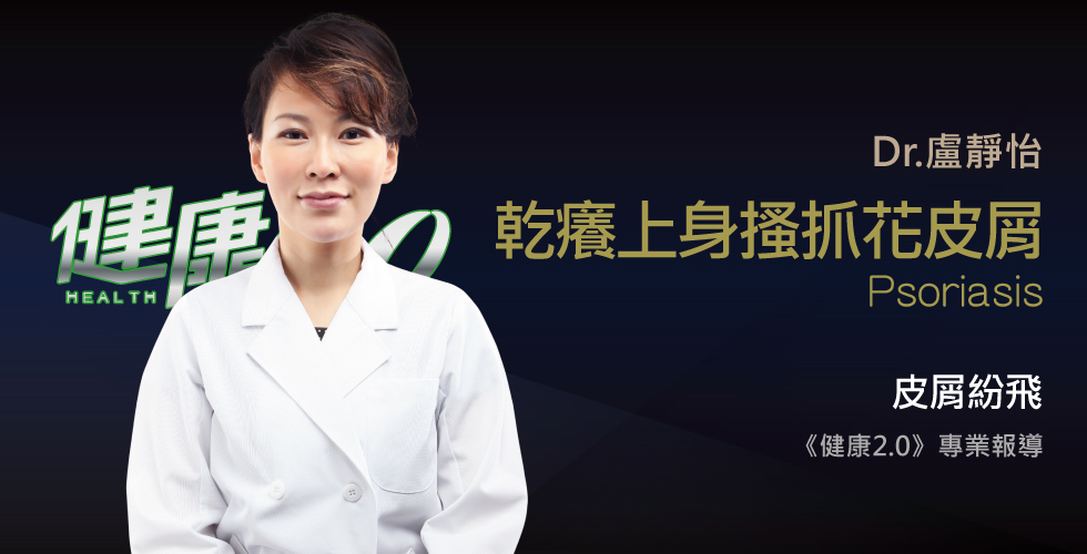 盧靜怡醫師受邀《健康2.0》頭皮屑不能等，恐併發關節炎、憂鬱症、心肌梗塞？！