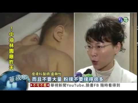 iskin盧靜怡醫師受訪《華視新聞》評價談爽身粉恐致癌